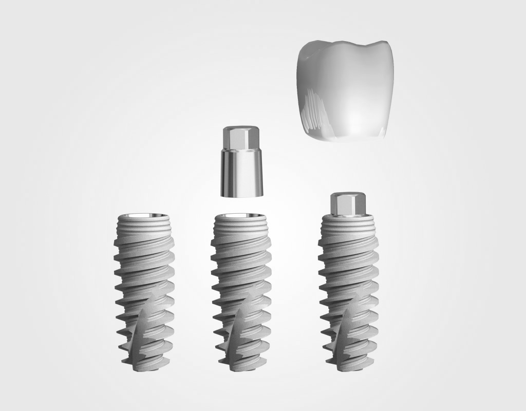 Implantes dentales Palau-Solità i Plegamans